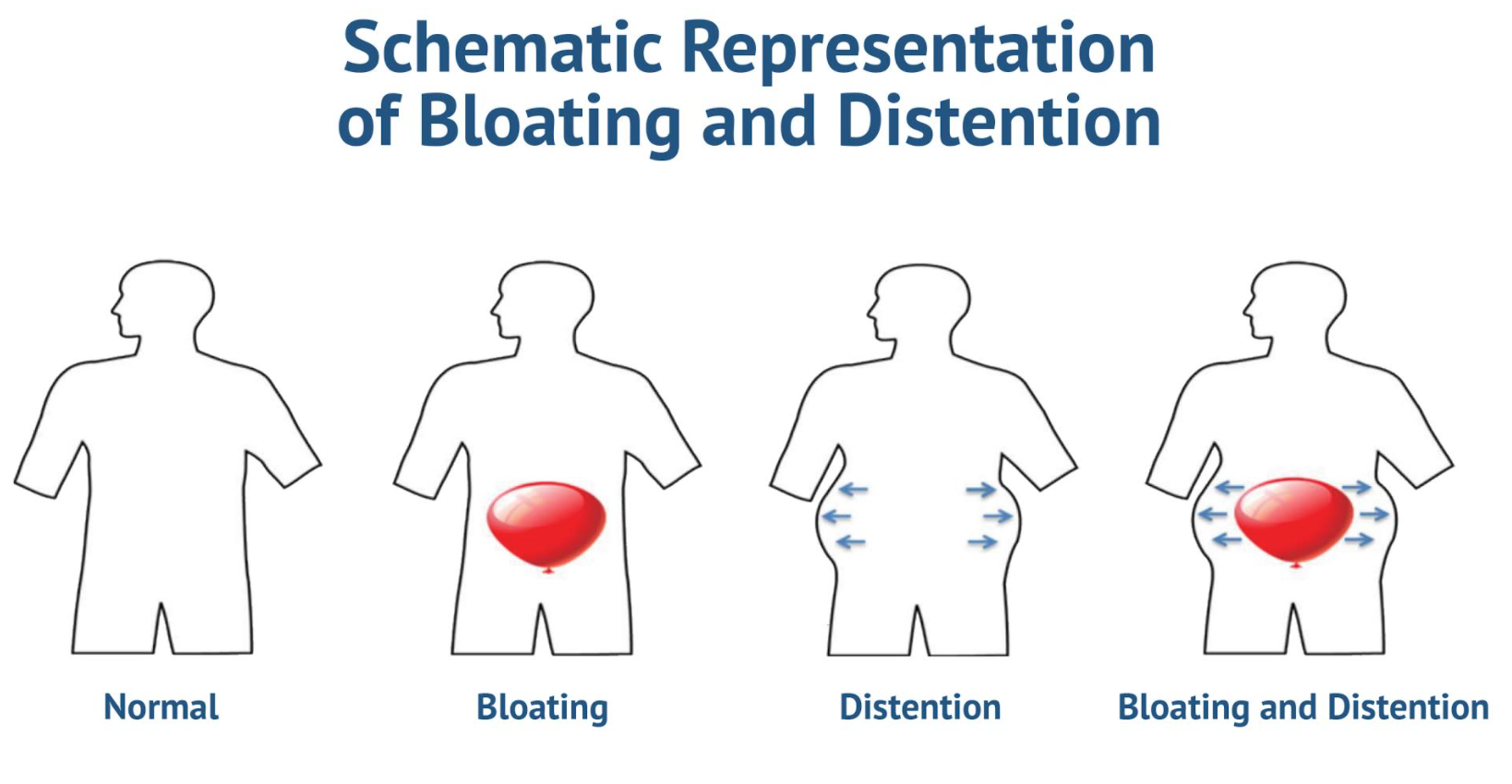 Bloating and Distension: What’s the Difference?